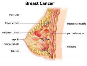 File:How to examine your breasts, extracted from Mammograms and breast  cancer (1998).jpg - Wikipedia